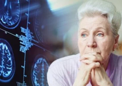 КАКВО Е АЛЦХАЙМЕР И КОЛКО ЖИВЕЯТ БОЛНИТЕ?