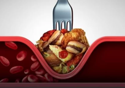 ВИСОК ХОЛЕСТЕРОЛ - КАК ДА ГО СВАЛИМ У ДОМА БЕЗ ЛЕКАРСТВА?