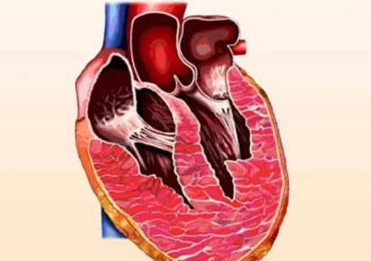 УГОЛЕМЕНО СЪРЦЕ : РИСКОВЕ, ДИАГНОЗА, ЛЕЧЕНИЕ