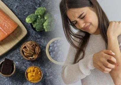 НАЙ-ЕФИКАСНОТО ЛЕКАРСТВО ЗА ПСОРИАЗИС | ПСОРИАЗИС ПРИЧИНИ