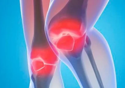 ГОНАРТРОЗА ЛЕЧЕНИЕ | ХРАНЕНЕ ПРИ ГОНАРТРОЗА | БИЛКИ