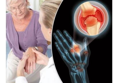 НАЙ-ЕФИКАСНОТО ЛЕКАРСТВО ЗА ПОДАГРА | БИЛКИ И РЕЦЕПТИ