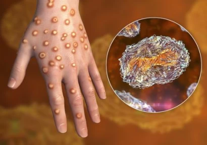 НОВИЯТ ЩАМ НА МАЙМУНСКА ШАРКА АТАКУВА ХОМОСЕКСУАЛНИТЕ МЪЖЕ