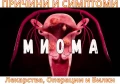 МИОМА НА МАТКАТА | СИМПТОМИ - ЛЕКАРСТВА, ОПЕРАЦИИ И БИЛКИ