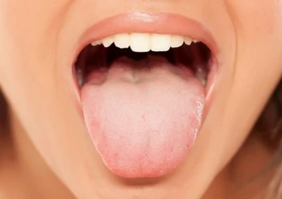 ГЪБИЧКИ В УСТАТА - МЛЕЧНИЦА | ЛЕКАРСТВА, ПРОБИОТИЦИ И БИЛКИ