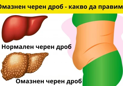 ХАПЧЕТА ЗА ОМАЗНЕН ЧЕРЕН ДРОБ | НАРОДНО ЛЕЧЕНИЕ И БИЛКИ