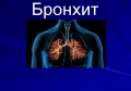 БРОНХИТ СИМПТОМИ | НАЙ-ДОБЪР АНТИБИОТИК ЗА БРОНХИТ