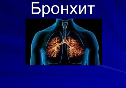 БРОНХИТ СИМПТОМИ | НАЙ-ДОБЪР АНТИБИОТИК ЗА БРОНХИТ