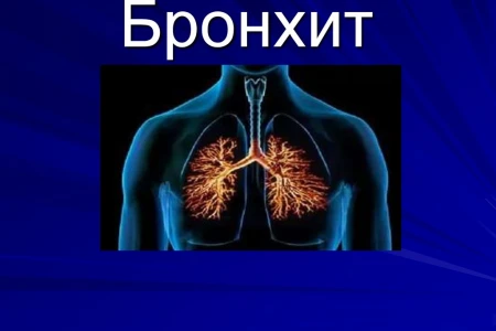 БРОНХИТ СИМПТОМИ | НАЙ-ДОБЪР АНТИБИОТИК ЗА БРОНХИТ