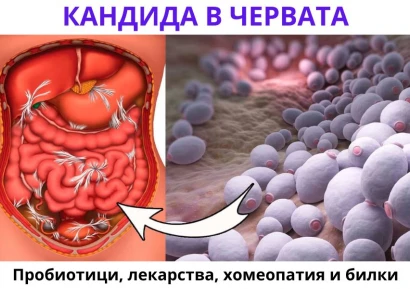 ПРОБИОТИК ЗА КАНДИДА В ЧЕРВАТА | ЛЕКАРСТВА И ДИЕТА
