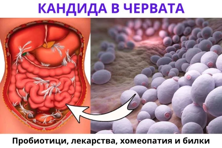 ПРОБИОТИК ЗА КАНДИДА В ЧЕРВАТА | ЛЕКАРСТВА И ДИЕТА