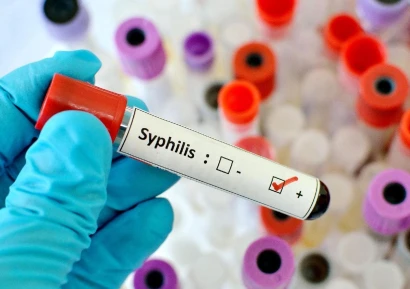 СИФИЛИС СИМПТОМИ | ЛЕЧЕНИЕ И ИЗСЛЕДВАНИЯ | КАК СЕ ПРЕДАВА