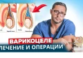 ВАРИКОЦЕЛЕ - ПРИЧИНИ И СИМПТОМИ | ОПЕРАТИВНО ЛЕЧЕНИЕ