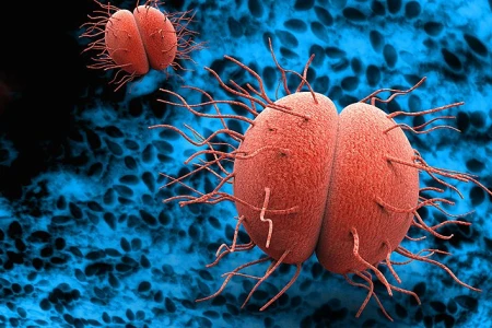 ТРИПЕР СИМПТОМИ | ВИДОВЕ ТРИПЕР И КАК СЕ ЛЕКУВА