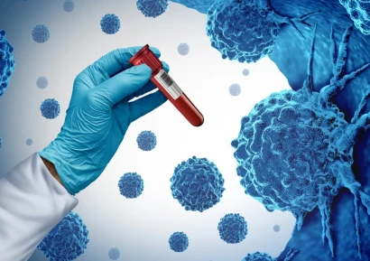 ULTIMATE CANCER PROTOCOL ПРИ ОНКОЛОГИИ - 105 ДНИ