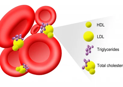 ДИЕТА ПРИ ВИСОКИ ТРИГЛИЦЕРИДИ | ДОБАВКИ И ЛЕКАРСТВА