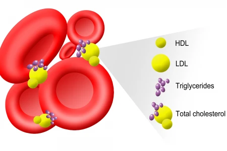 ДИЕТА ПРИ ВИСОКИ ТРИГЛИЦЕРИДИ | ДОБАВКИ И ЛЕКАРСТВА