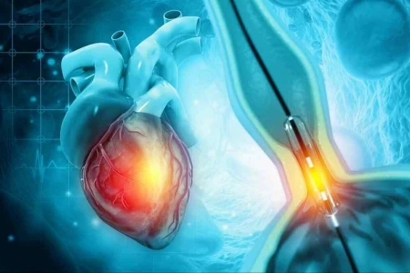 ВЪЗСТАНОВЯВАНЕ СЛЕД КОРОНАРОГРАФИЯ | СТРАНИЧНИ ЕФЕКТИ