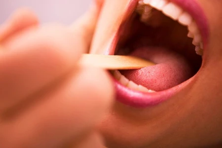 КОЛКО ВРЕМЕ ПРОДЪЛЖАВА ГНОЙНА АНГИНА? СИМПТОМИ И ЛЕЧЕНИЕ