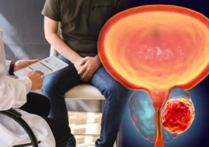 УМИРА ЛИ СЕ ОТ РАК НА ПРОСТАТАТА | РАК НА ПРОСТАТАТА ЛЕЧЕНИЕ