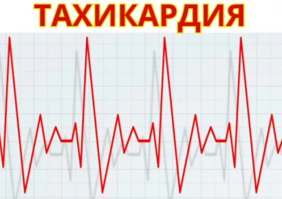 СИНУСОВА ТАХИКАРДИЯ | ТАХИКАРДИИ ЛЕЧЕНИЕ | ЛЕКАРСТВА И БИЛКИ