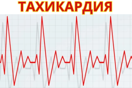 СИНУСОВА ТАХИКАРДИЯ | ТАХИКАРДИИ ЛЕЧЕНИЕ | ЛЕКАРСТВА И БИЛКИ