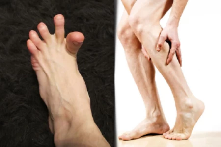 КРАМПИ В КРАКАТА - НАРОДНО ЛЕЧЕНИЕ НА КРАМПИ