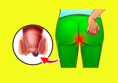 ХЕМОРОИДИ - КАК ДА СЕ ИЗБАВИТЕ ЗАВИНАГИ?